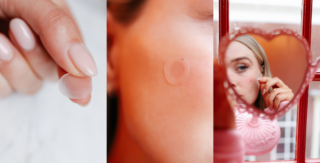 Say goodbye to pimple popping!